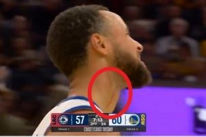 库里:血痕是之前打湖人那场留下的 看起来要比实际情况严重 库里:血痕是之前打湖人那场留下的 看起来要比实际情况严重